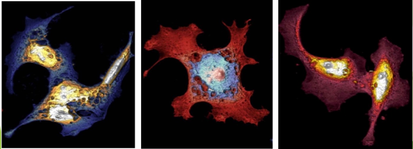 When Science Embraces Art - Cells Undergoing Programmed Death